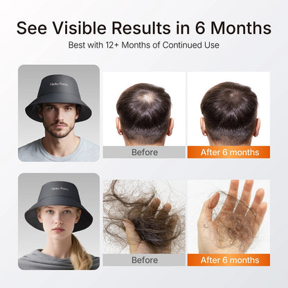 Hello Face T100 Red Light Therapy Hair Growth Bucket Hat